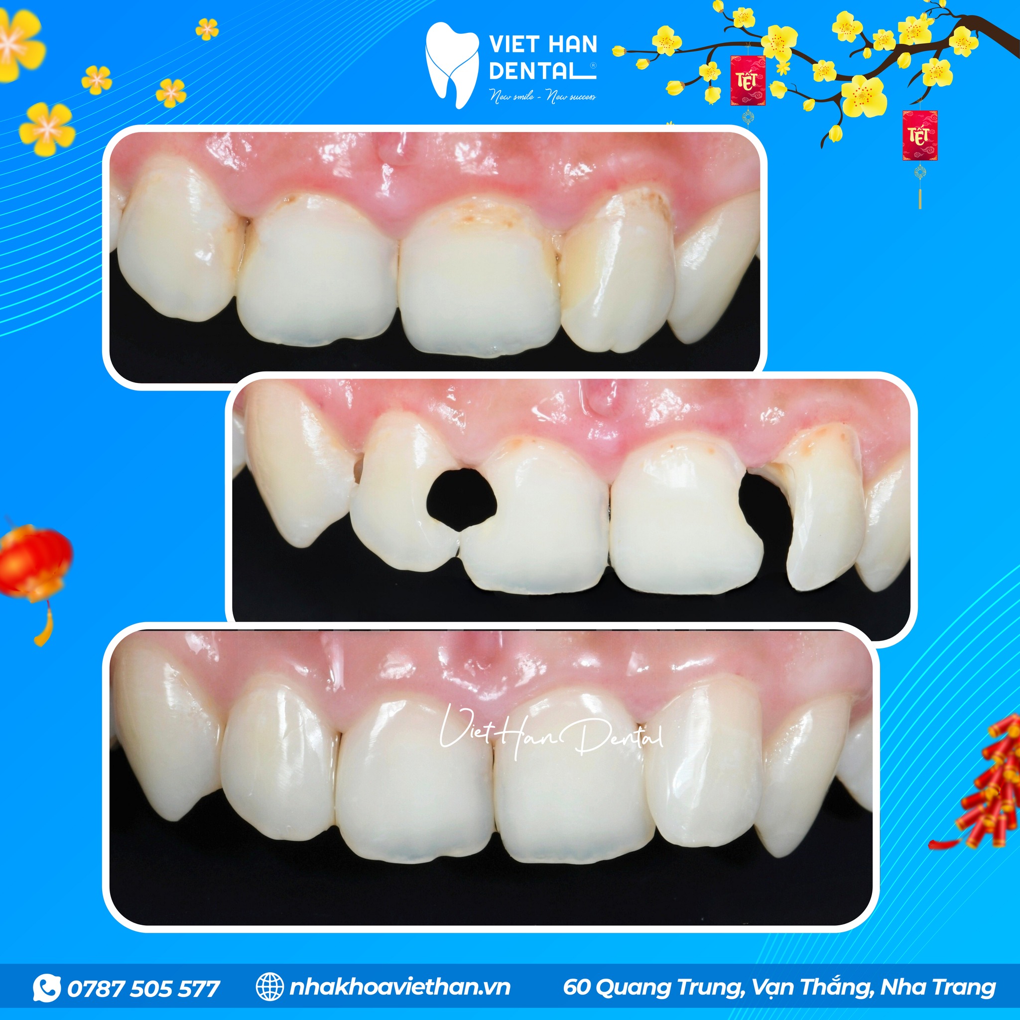 599789546 122177541164385286 7930241660635023151 N