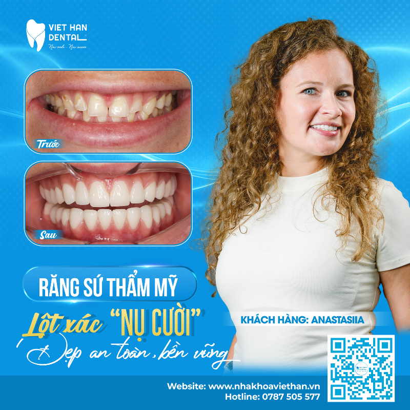 Kh Trước Sau Có Thông Tin (2)