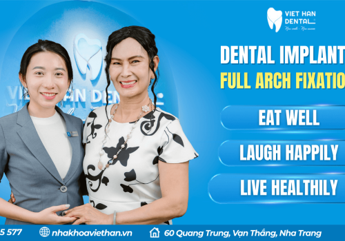 Trồng Implant Hàm Trên (1)