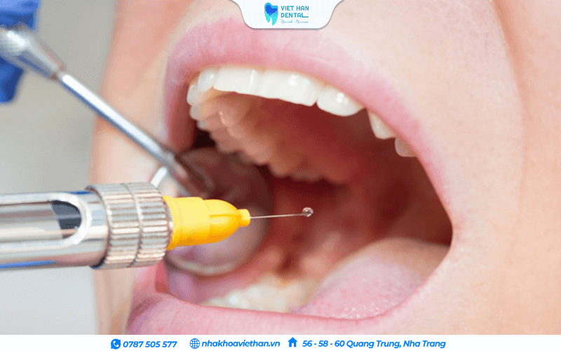 Thuốc tê giúp làm mất cảm giác đau tại vùng được tiêm