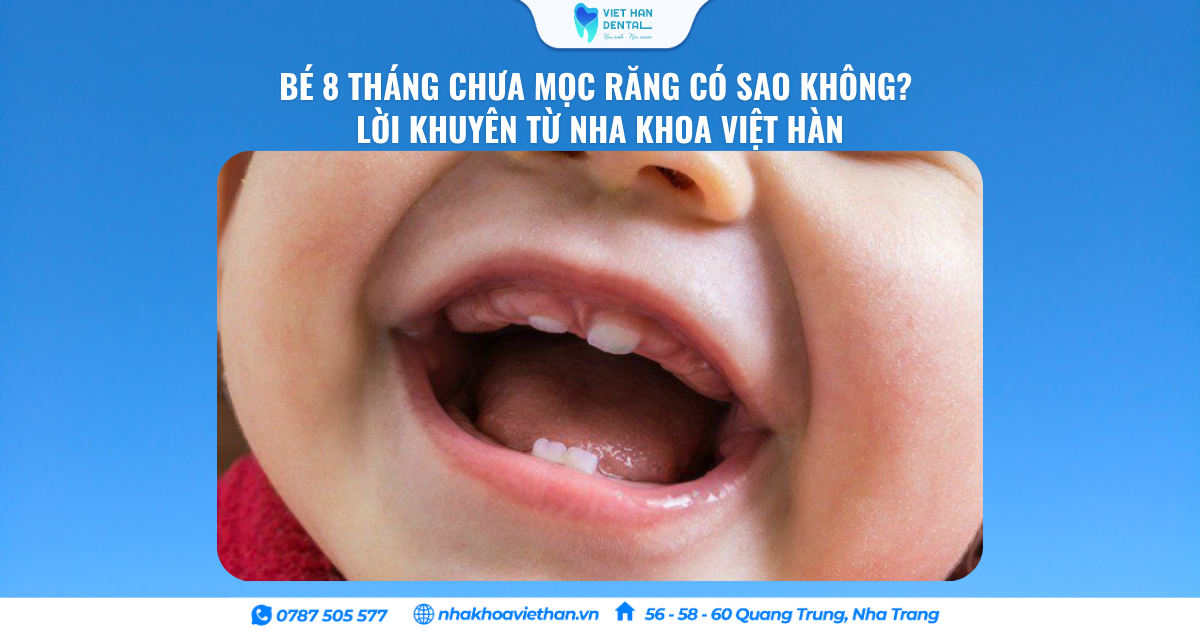 Bé 8 Tháng Chưa Mọc Răng Có Sao Không? Lời Khuyên Từ Nha Khoa Việt Hàn