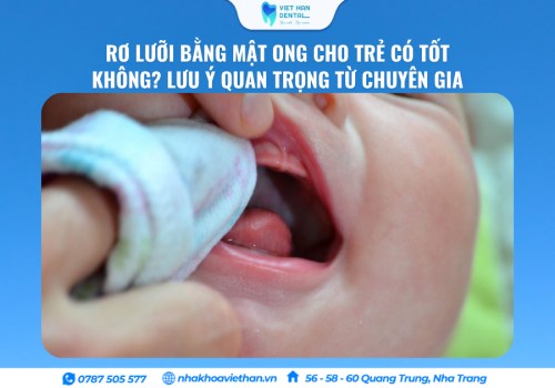 Rơ Lưỡi Bằng Mật Ong Cho Trẻ Có Tốt Không? Lưu Ý Quan Trọng Từ Chuyên Gia