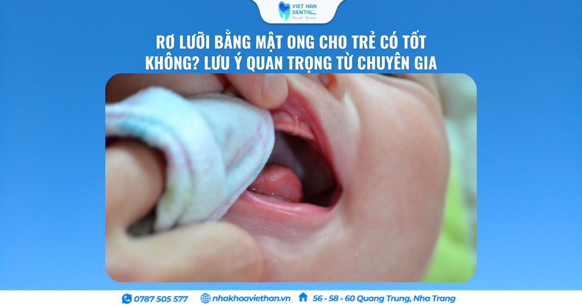 Rơ Lưỡi Bằng Mật Ong Cho Trẻ Có Tốt Không? Lưu Ý Quan Trọng Từ Chuyên Gia