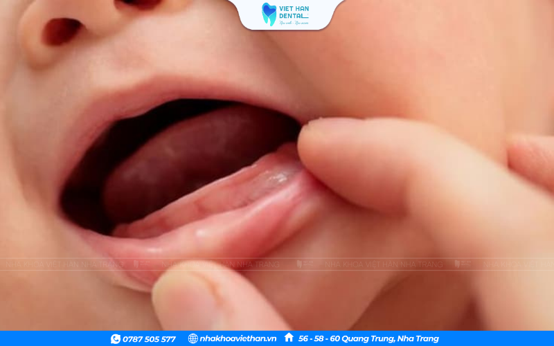 Bé 8 tháng chưa mọc răng