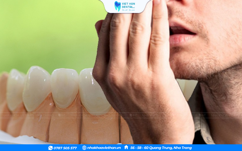 Răng Sứ (29)