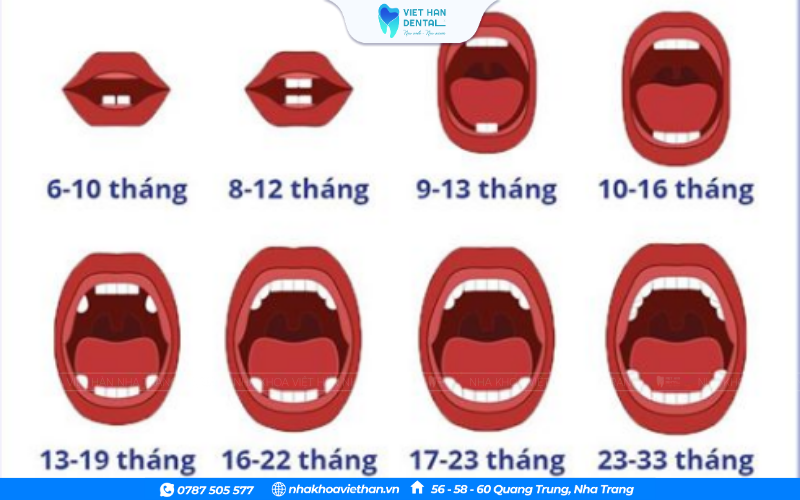 Lịch mọc răng sữa tiêu chuẩn