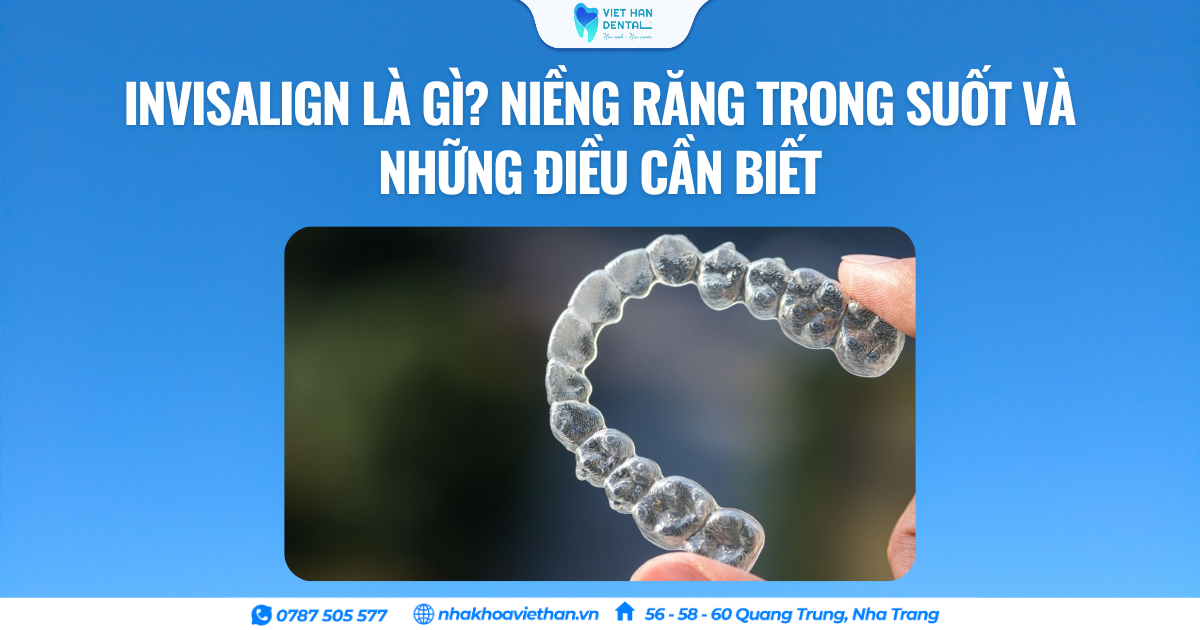 Invisalign là gì? Niềng răng trong suốt và những điều cần biết