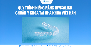 Quy trình niềng răng Invisalign chuẩn y khoa tại Nha khoa Việt Hàn