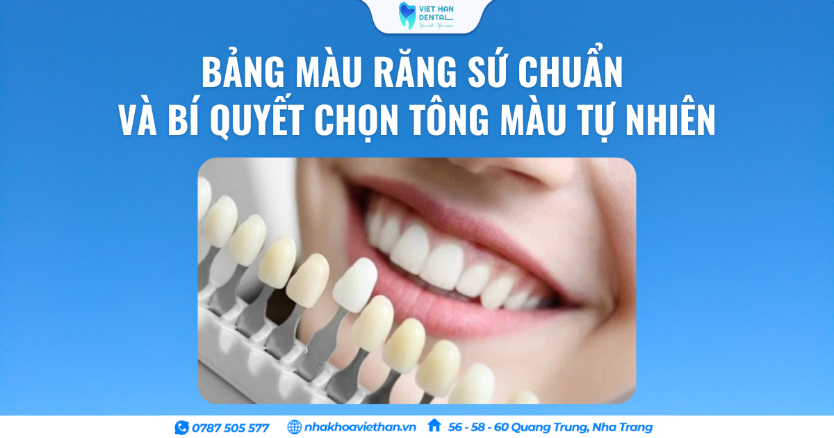 Bảng Màu Răng Sứ Chuẩn Và Bí Quyết Chọn Tông Màu Tự Nhiên