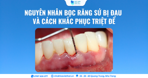 Nguyên Nhân Bọc Răng Sứ Bị Đau Và Cách Khắc Phục Triệt Để