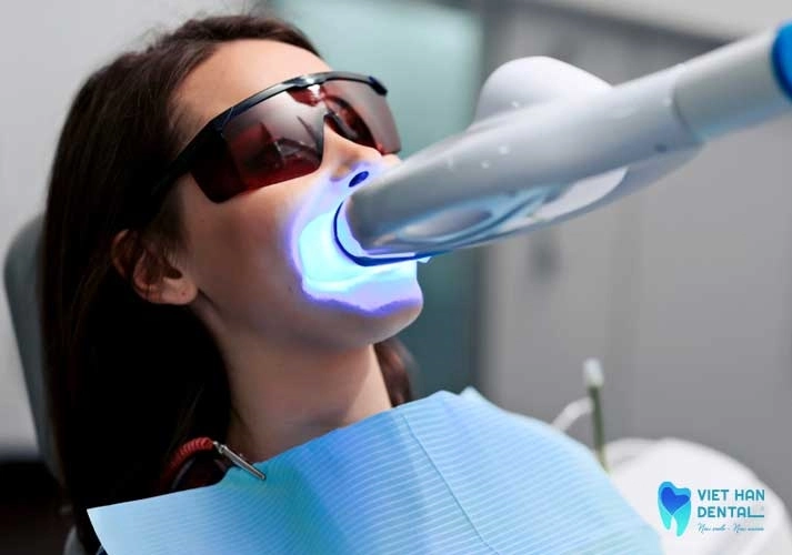 Tay Trang Nha Khoa Final