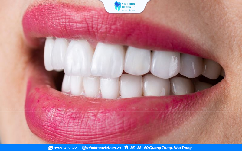 Nếu làm nguyên hàm, bạn có thể thoải mái chọn tông sáng.