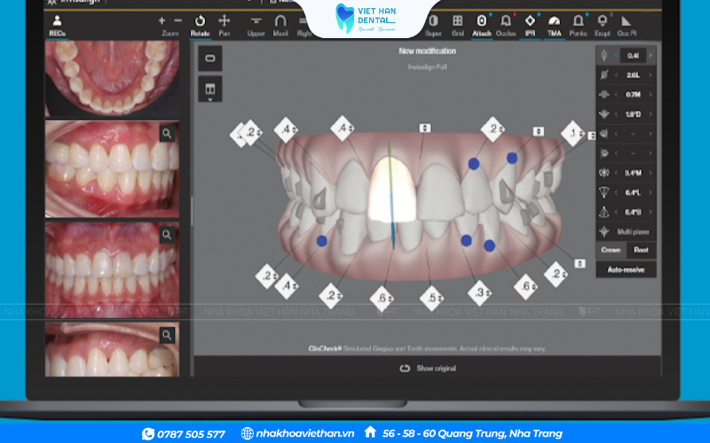 Bạn có thể thảo luận cùng bác sĩ để thống nhất kết quả cuối cùng.