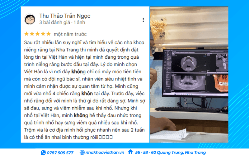 Khách hàng đánh giá dịch vụ nhổ răng khôn tại Nha khoa Việt Hàn (Nguồn: Google Maps)