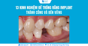 Cover Web