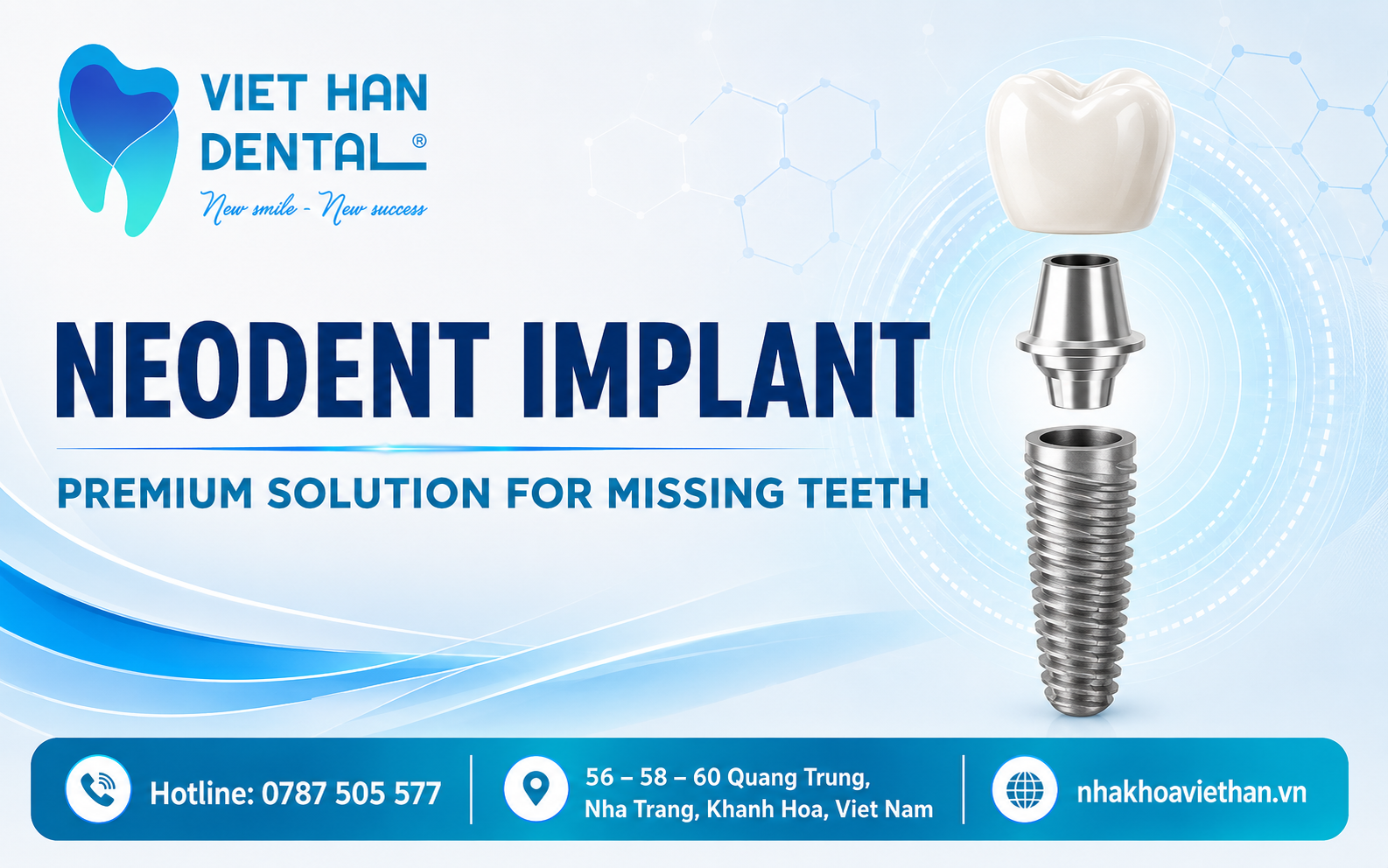 Neodent Implant