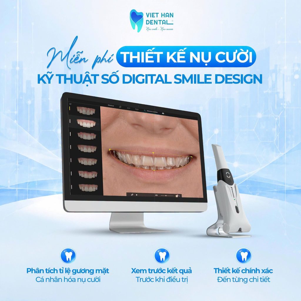 Miễn phí thiết kế nụ cười Digital Smile Design