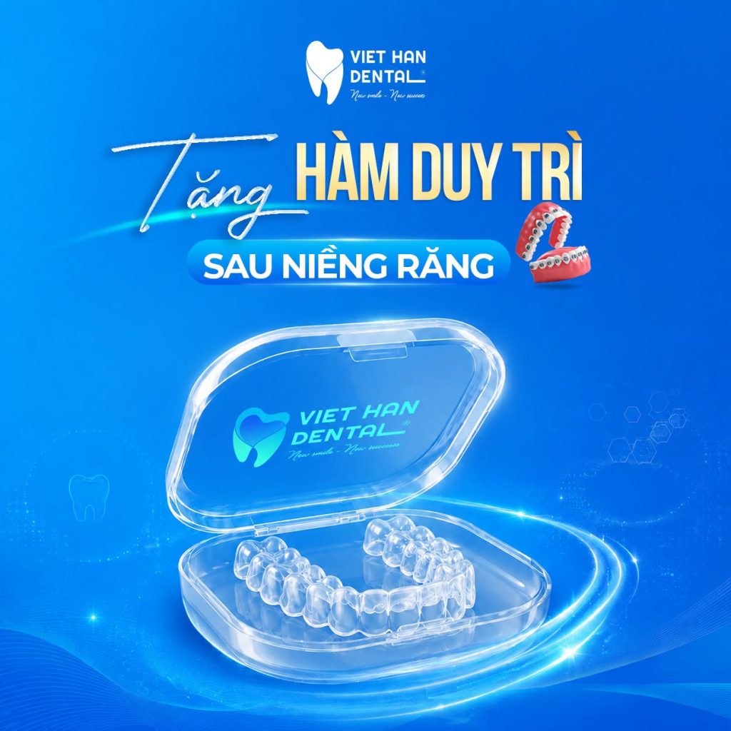 Tặng hàm duy trì sau khi kết thúc hành trình niềng răng