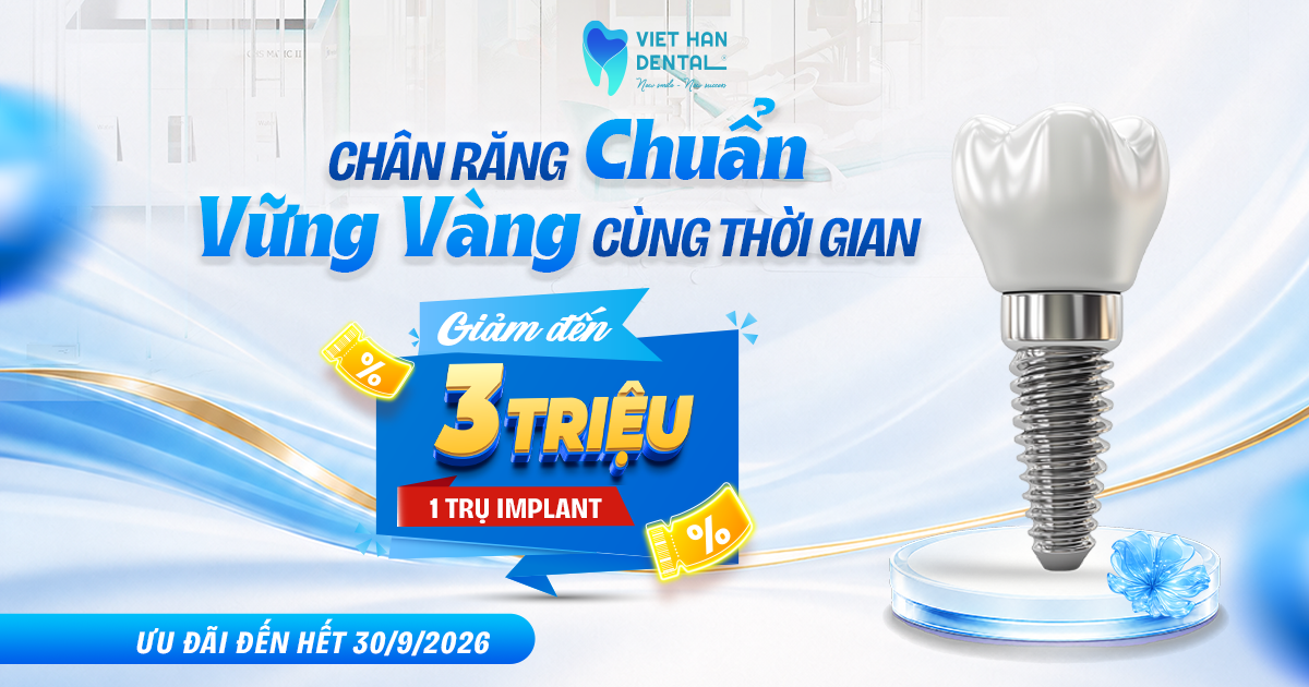 Ưu đãi Implant đặc biệt thay lời tri ân 10 năm đồng hành