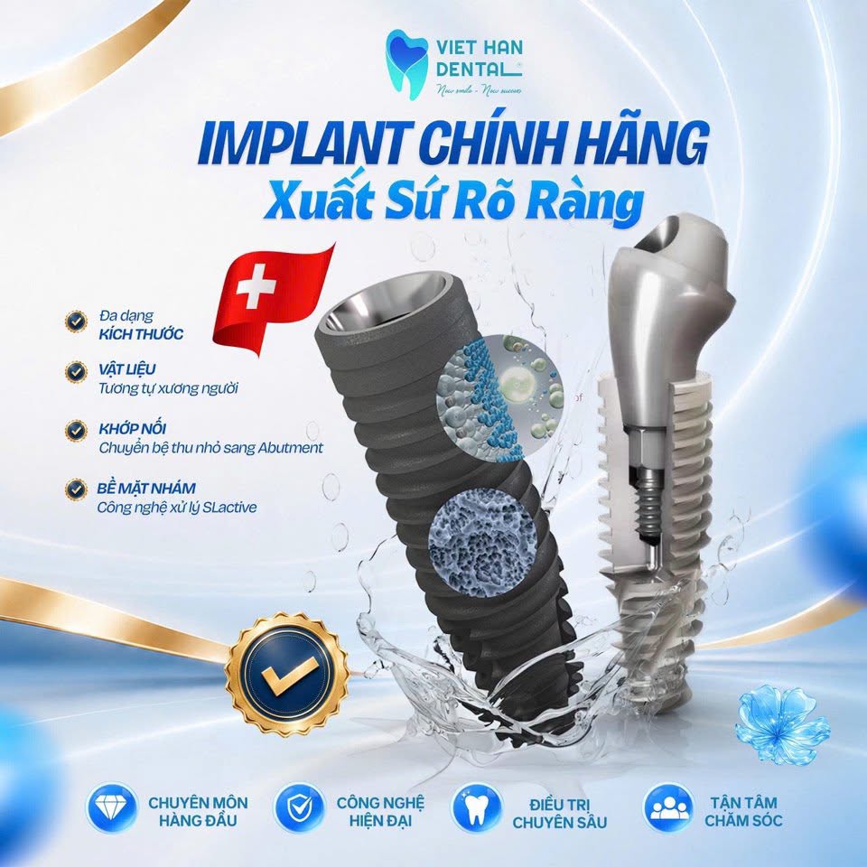 Xuất xứ Implant rõ ràng