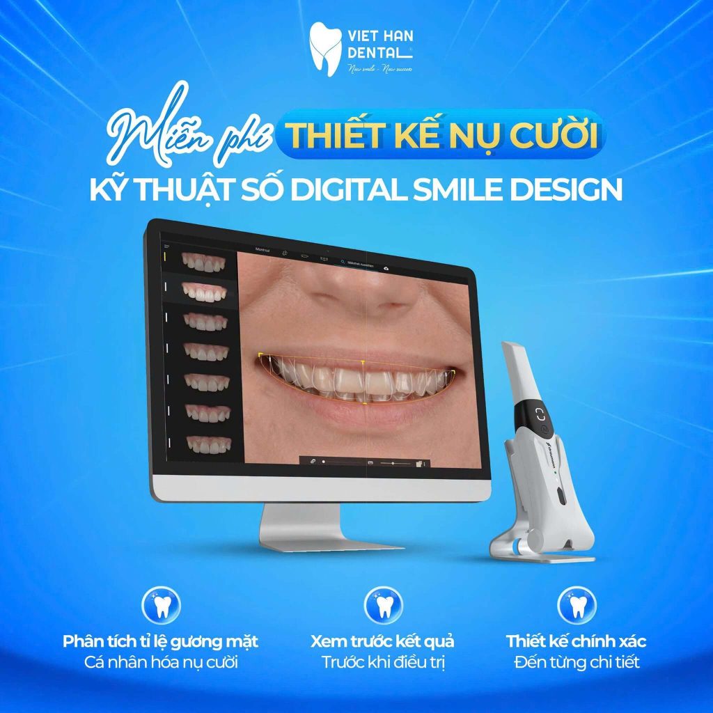 Miễn phí thiết kế nụ cười kỹ thuật số – Digital Smile Design