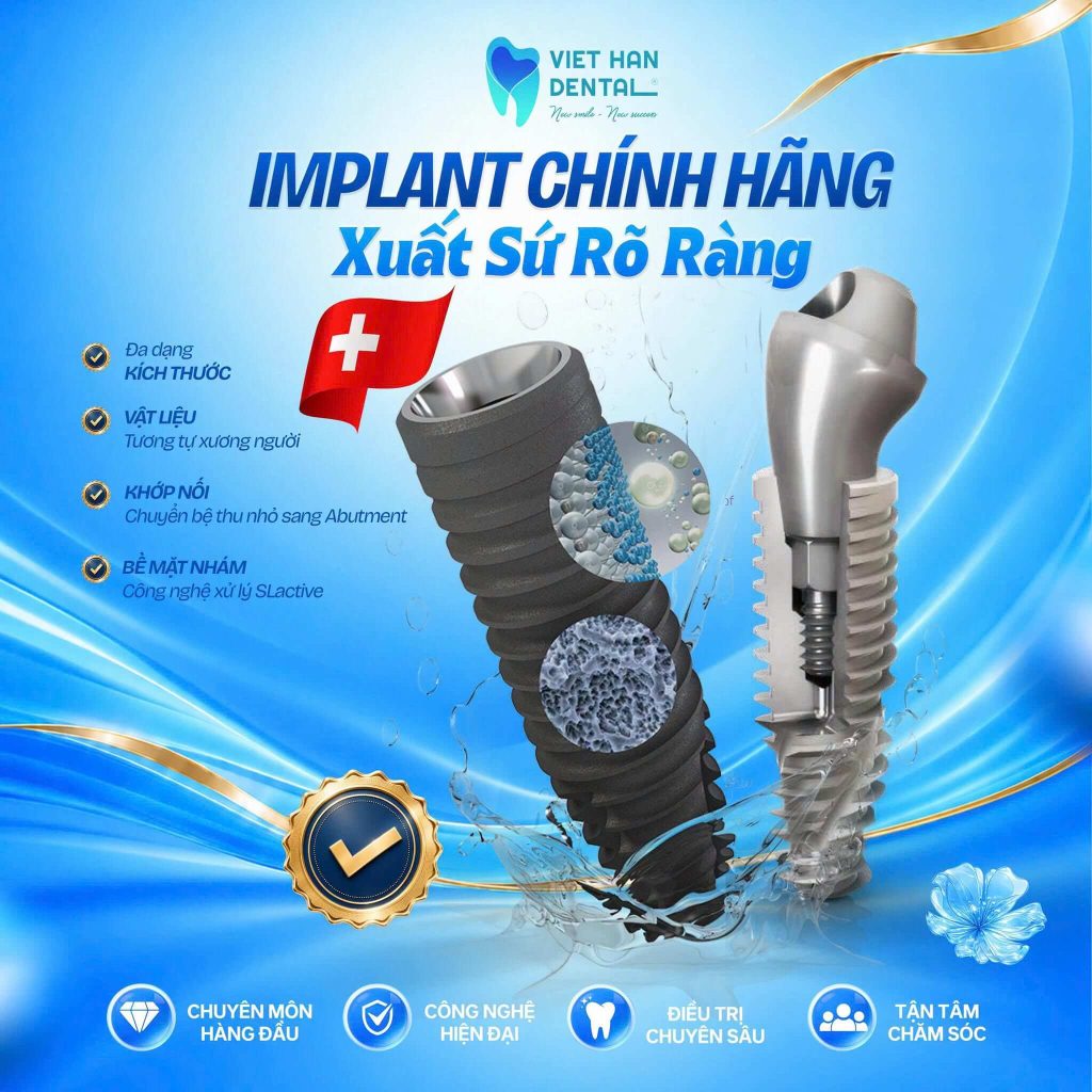 Trụ Implant tại Nha khoa Việt Hàn chính hãng, xuất xứ rõ ràng